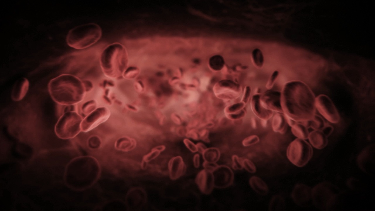 Challenges in Deep Vein Thrombosis and Post-Thrombotic Syndrome Thumbnail