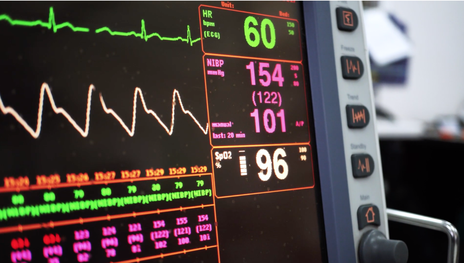 Artificial Intelligence for Assessing Patients Under Critical Care Thumbnail