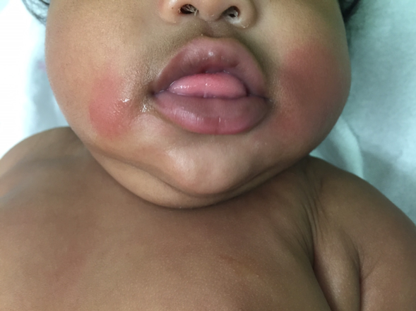 3 month old cold