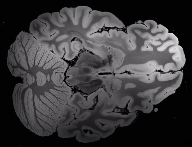 Is This the Highest Resolution MRI Scan of the Human Brain Ever? Thumbnail