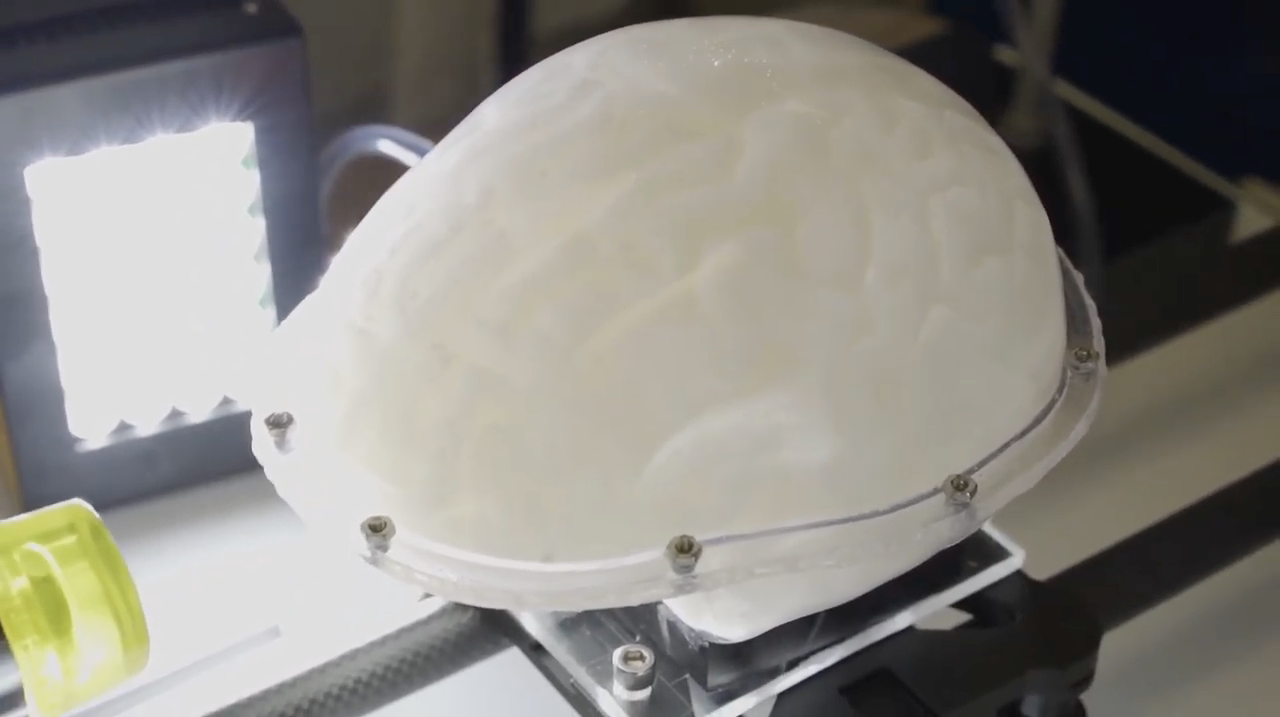 Model Could Offer Noninvasive Way to Study Brain Injury Thumbnail