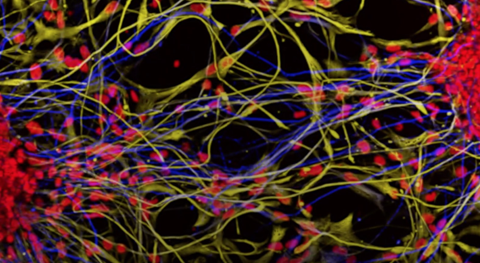 The Potential Benefits of Hematopoietic Stem Cell Gene Therapy Thumbnail