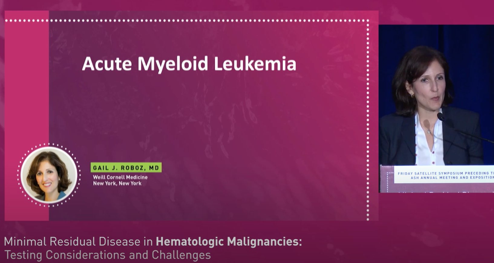 Minimal Residual Disease in Hematologic Malignancies: Testing Considerations and Challenges Thumbnail