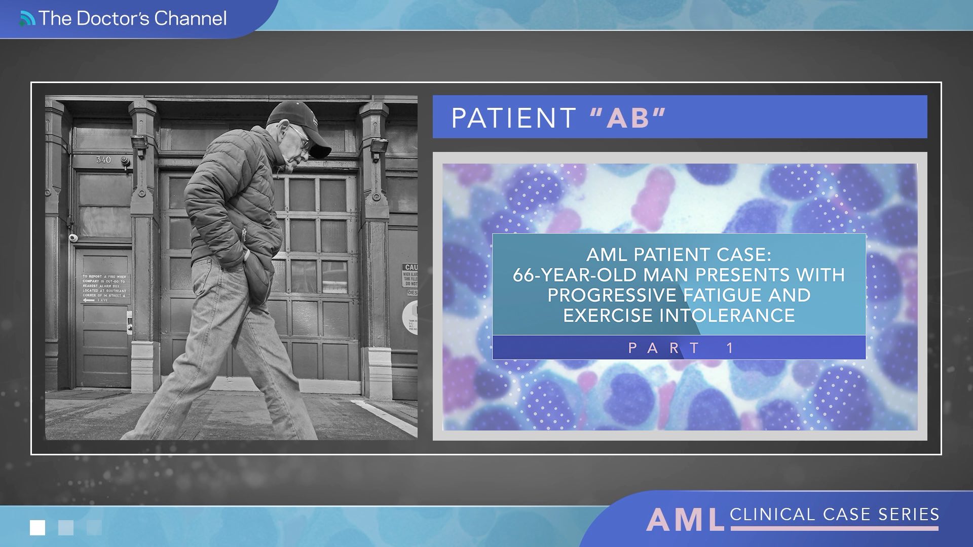 AML Patient Case: 66-Year-Old Man Presents With Progressive Fatigue and Exercise Intolerance Thumbnail