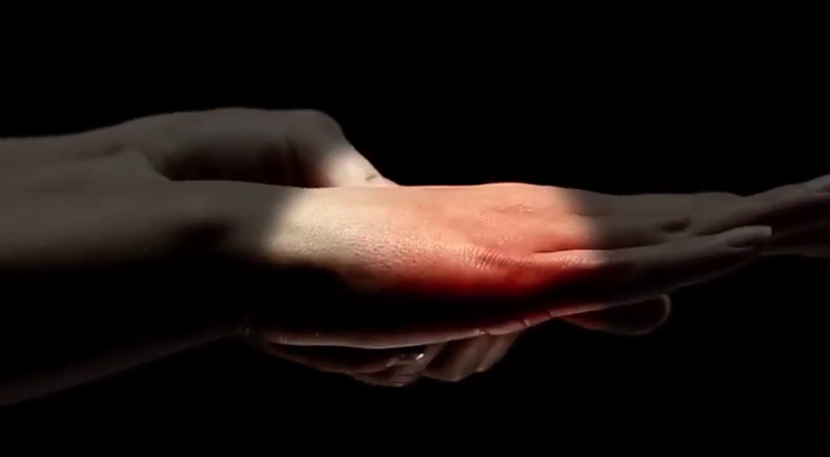 Pain and Inflammation in Rheumatoid Arthritis Thumbnail
