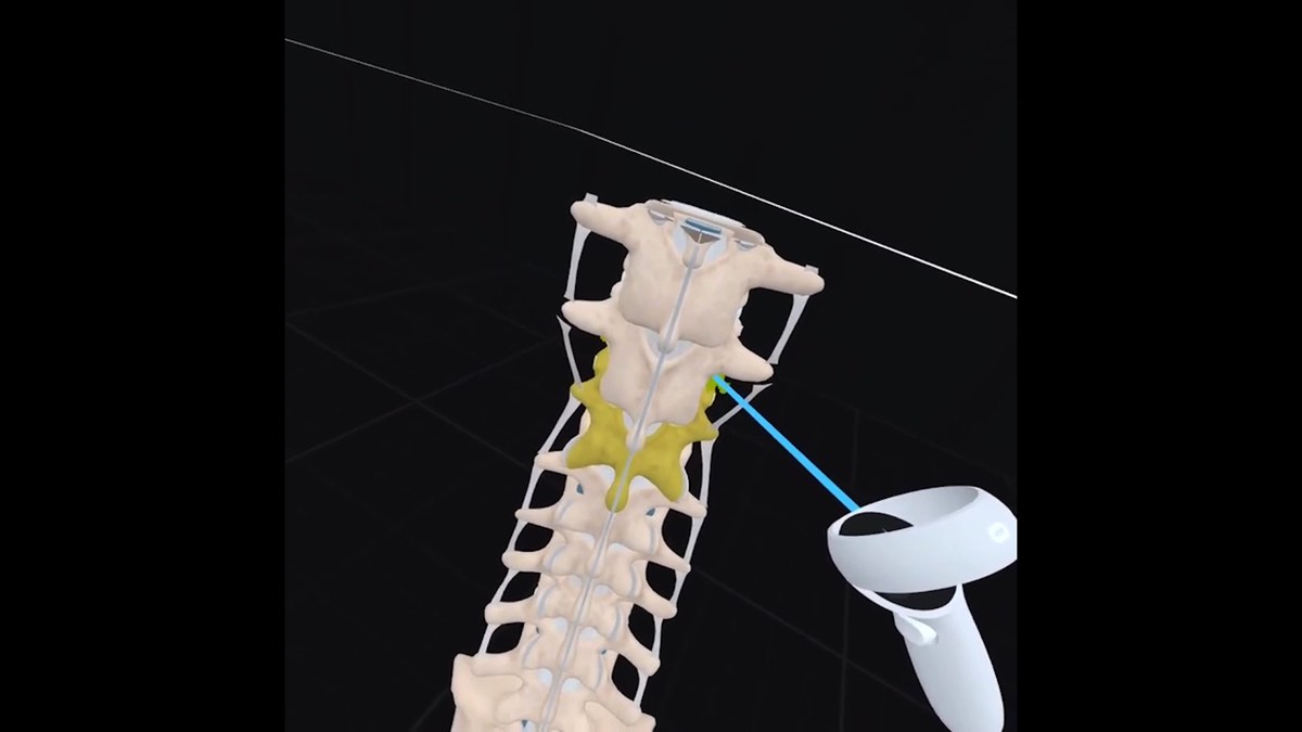 The Use of Virtual Reality for Pre-Procedural Planning and Practicing Thumbnail