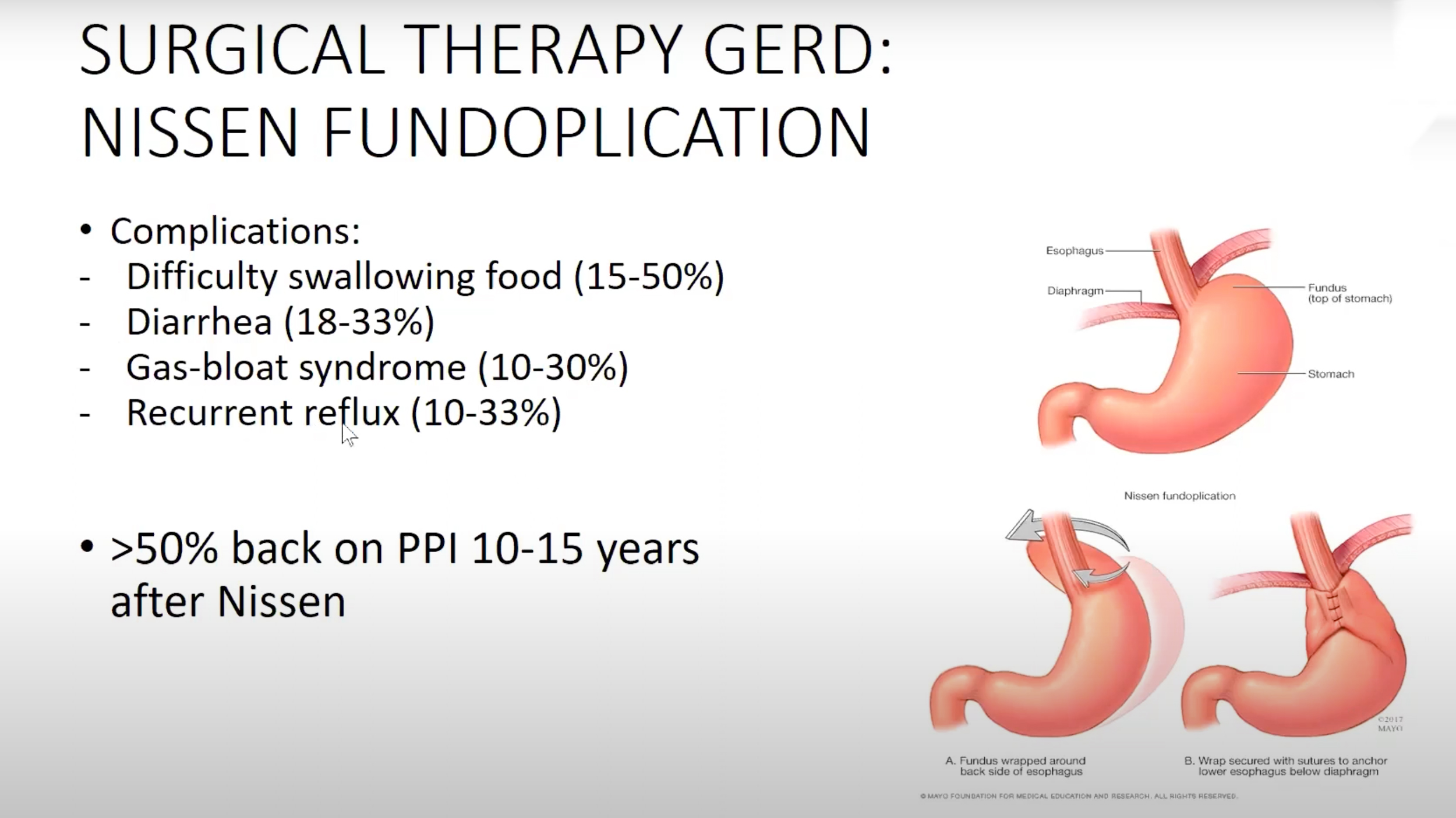GERD Diagnosis and Management: A Guide for Primary Care Providers Thumbnail