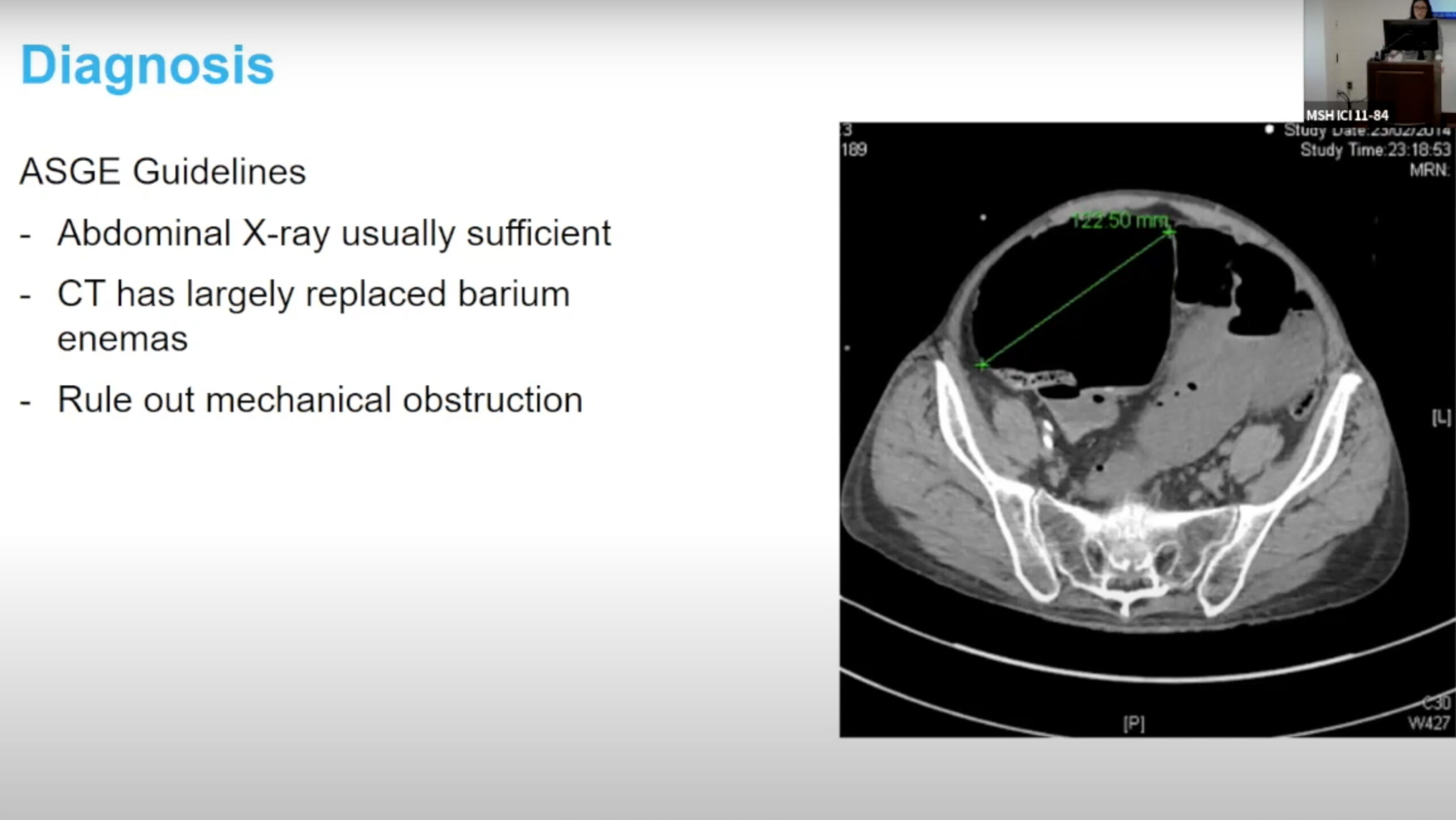 Management of Ogilvie’s Syndrome Thumbnail