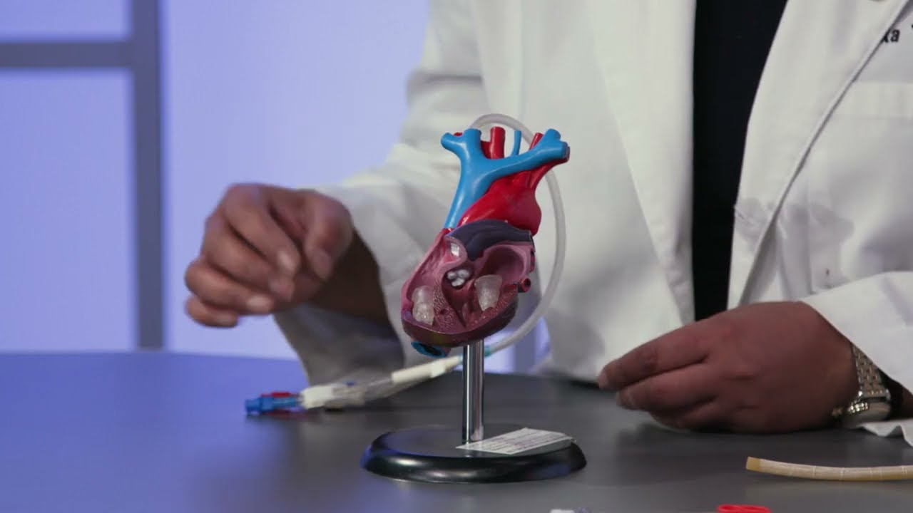 ABCs of Kidney Disease: Treatment Options for End-Stage Kidney Disease Thumbnail