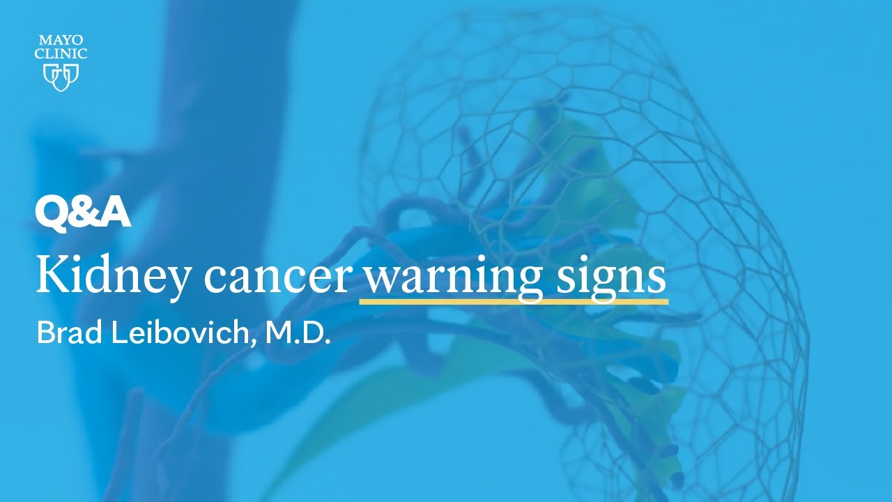 What are the Warning Signs of Kidney Cancer? Brad Leibovich, M.D., Mayo Clinic Thumbnail