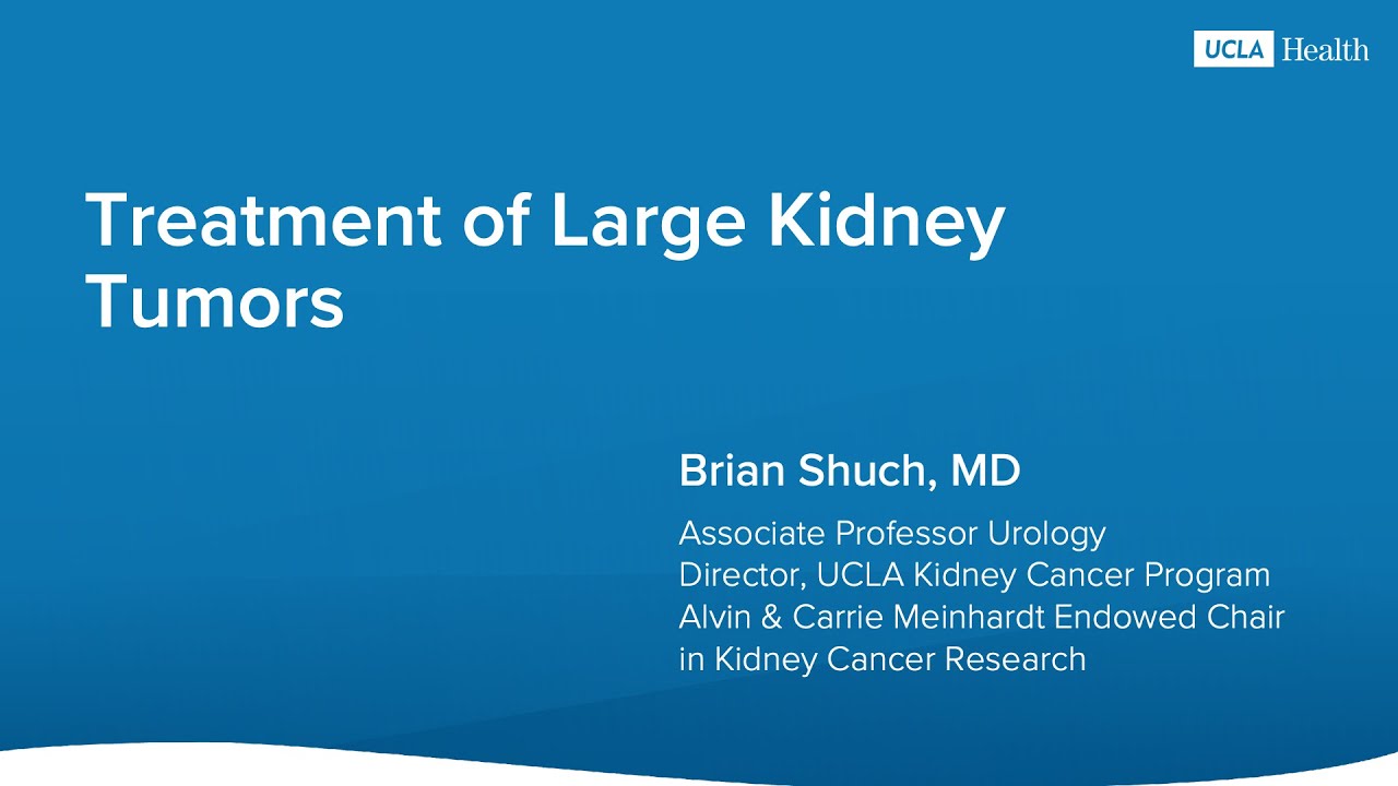 Treatment of Large Kidney Tumors | UCLA Health | Brian Shuch, MD Thumbnail