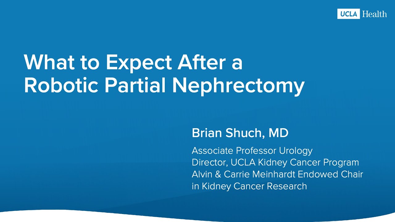 What to Expect After a Robotic Partial Nephrectomy | UCLA Health | Brian Shuch, MD Thumbnail