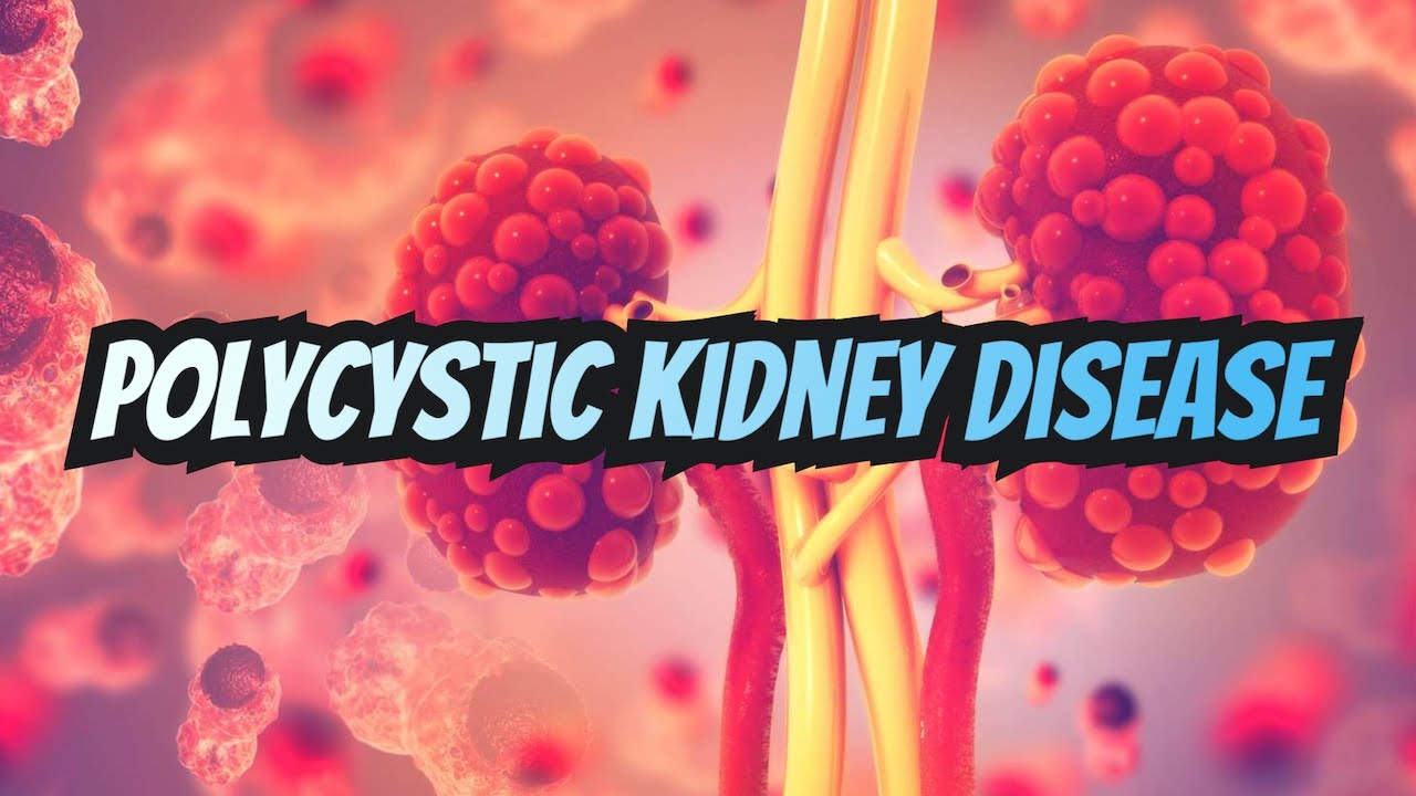 Polycystic Kidney Disease (updated 2023) – CRASH! Medical Review Series Thumbnail
