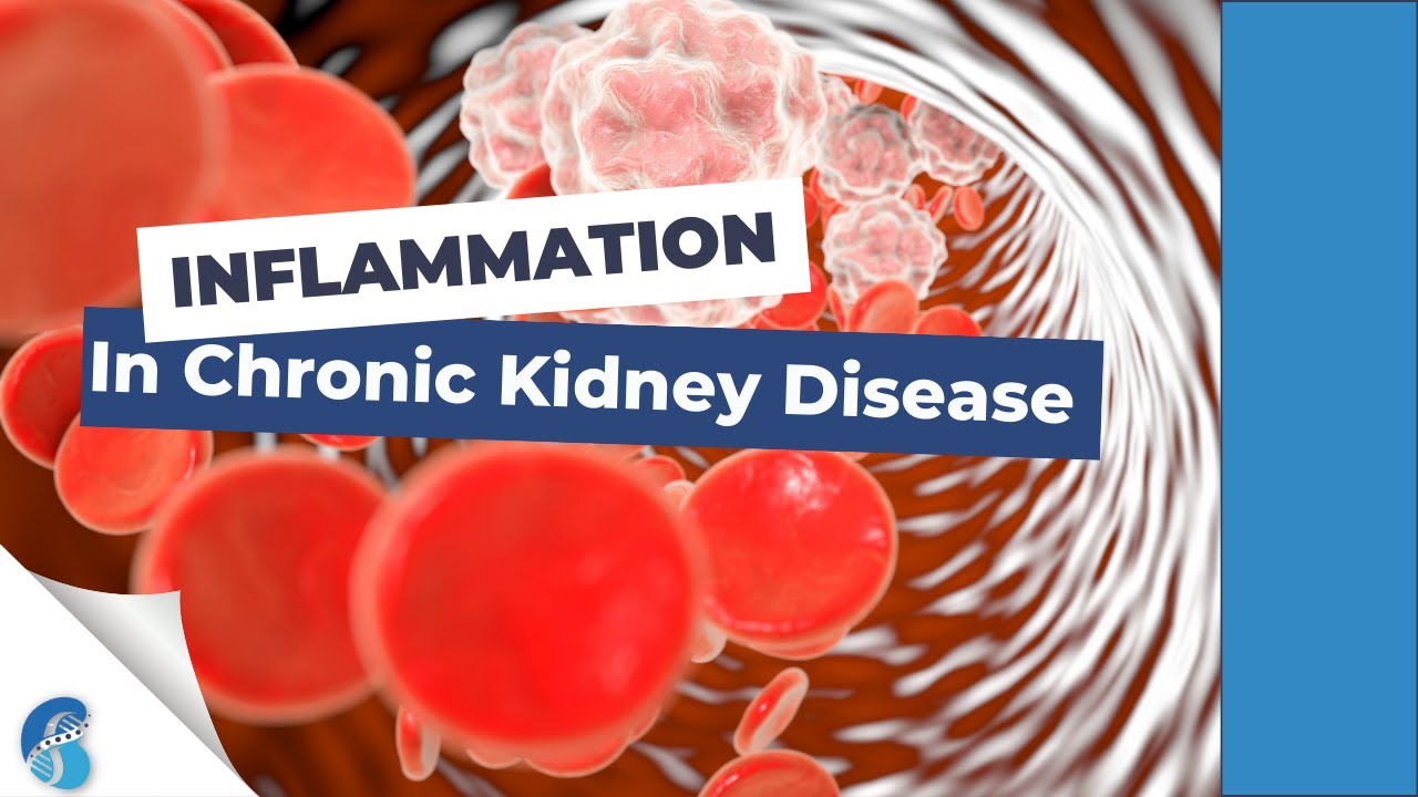 Inflammation in CKD Thumbnail
