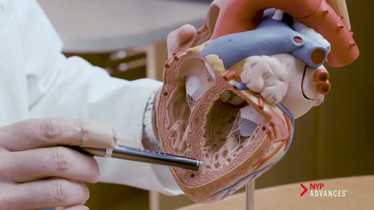 Repairing A Pediatric Swiss Cheese Heart The Doctor s Channel repairing-a-pediatric-swiss-cheese-heart-the-doctor-s-channel