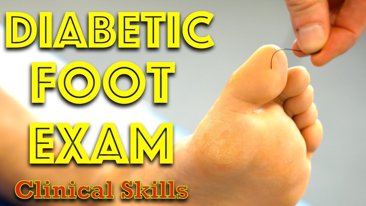 Diabetic Foot Examination – Clinical Skills – Dr. Gill Thumbnail