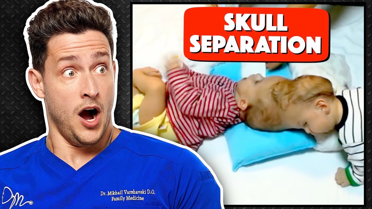 Modern Surgeries That Blow Doctors’ Minds Thumbnail