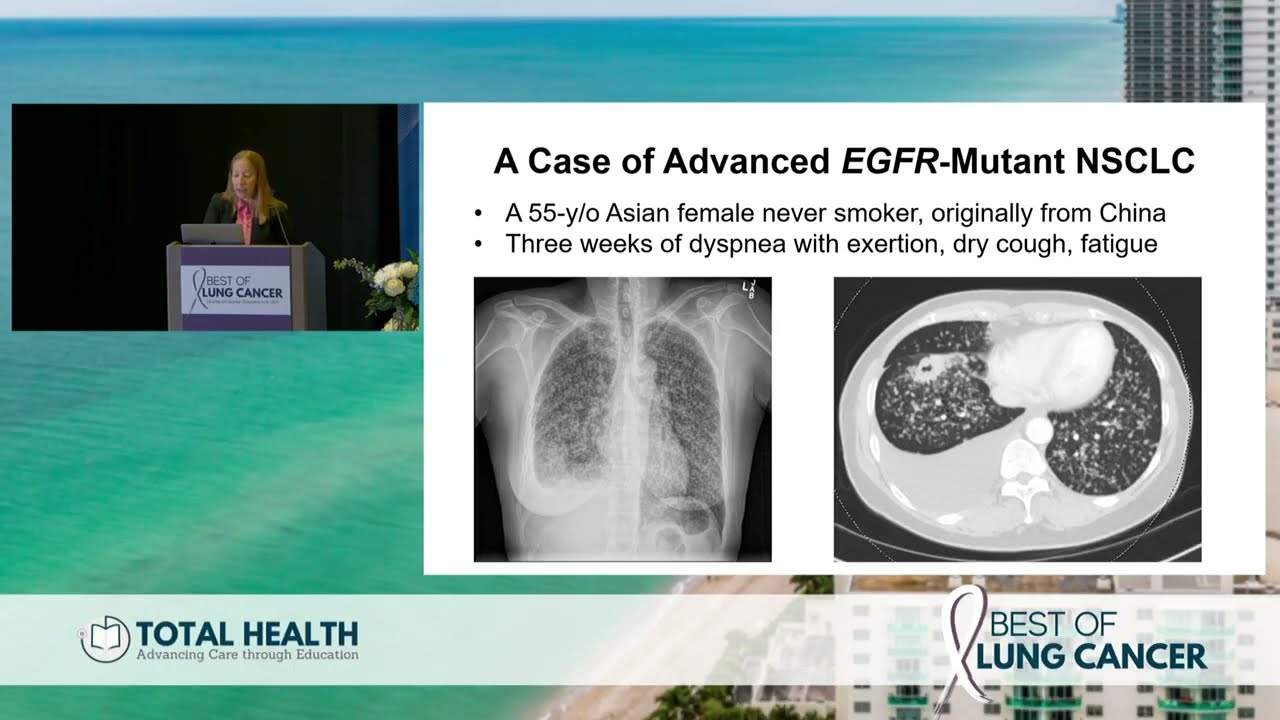 2023 Best of Lung: Targeted Therapies in Lung Cancer Thumbnail