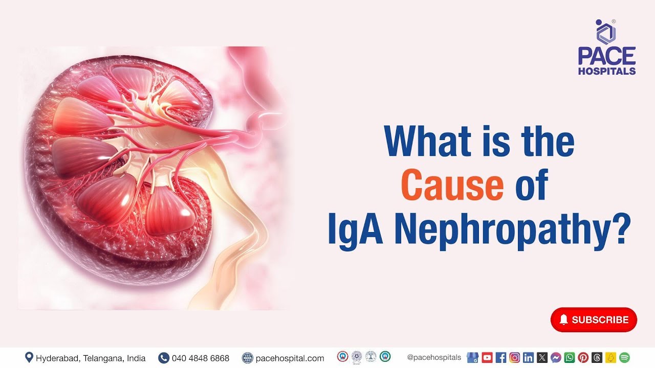 IgA Nephropathy Cause | What Is the Cause of IgA Nephropathy? Thumbnail