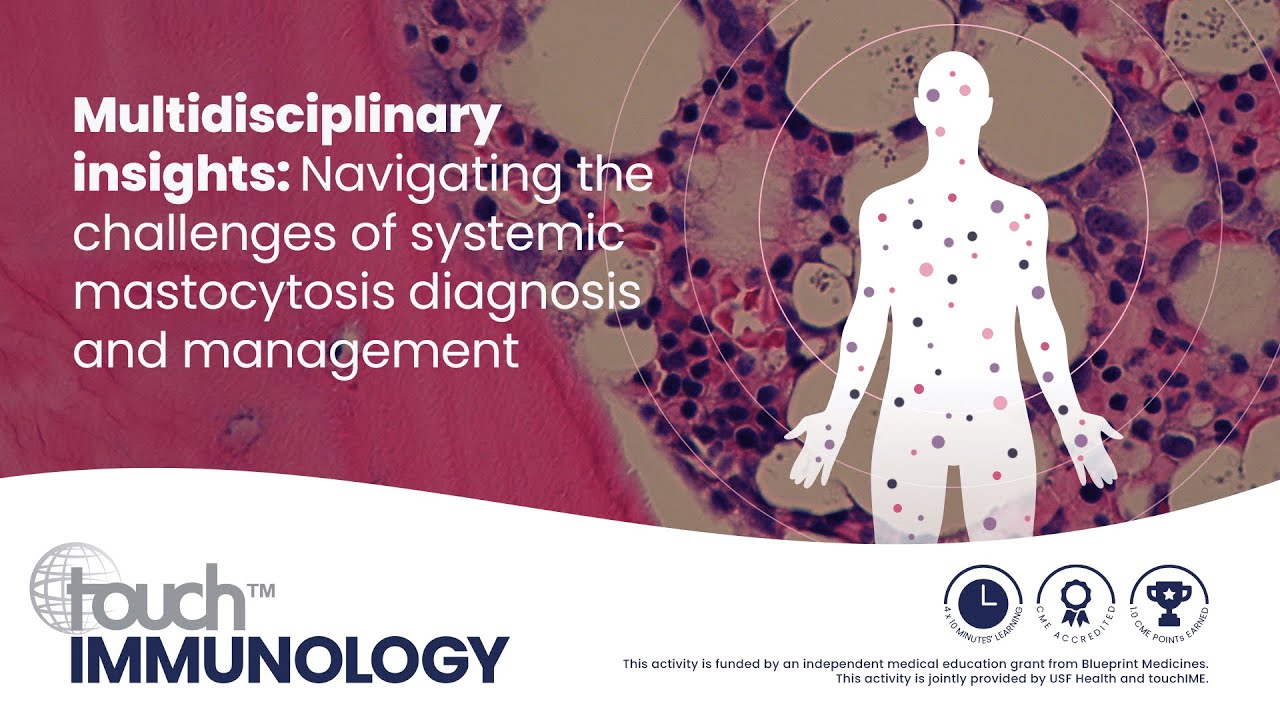 Challenges Associated With Diagnosis and Management of Systemic Mastocytosis Thumbnail