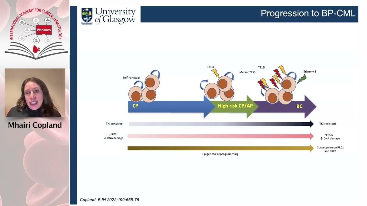 Management of Chronic Myeloid Leukemia (CML) in special populations Thumbnail