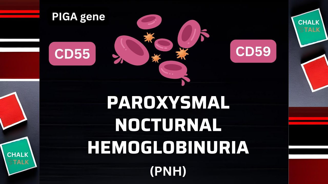 Paroxysmal Nocturnal Hemoglobinuria – Understanding PNH Thumbnail