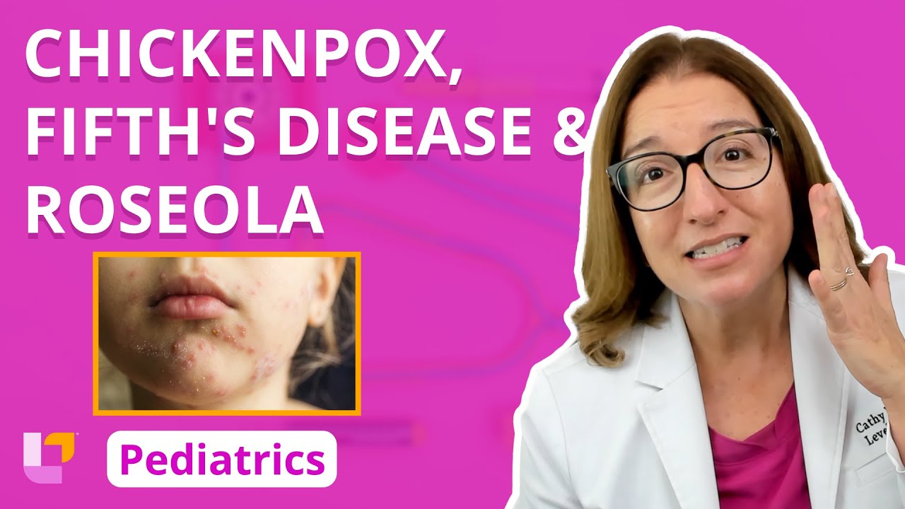 Chickenpox, Fifth’s Disease, & Roseola: Alterations in Health – Pediatric Nursing Thumbnail