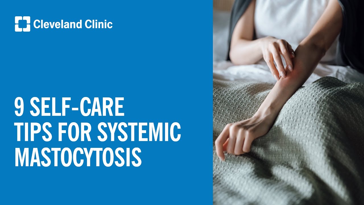 Living With Systemic Mastocytosis: Self-Care Tips Thumbnail