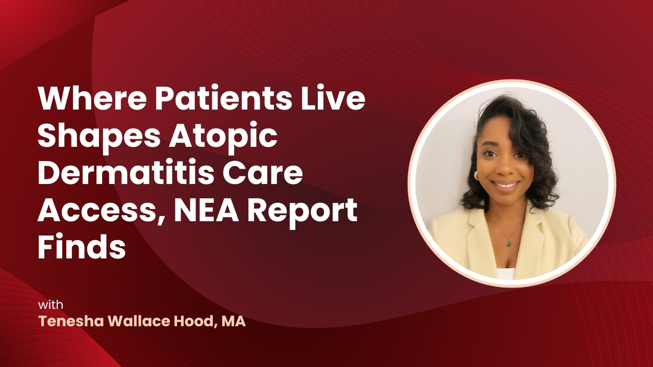 How State Data Reveal Gaps in Atopic Dermatitis Care Access Thumbnail